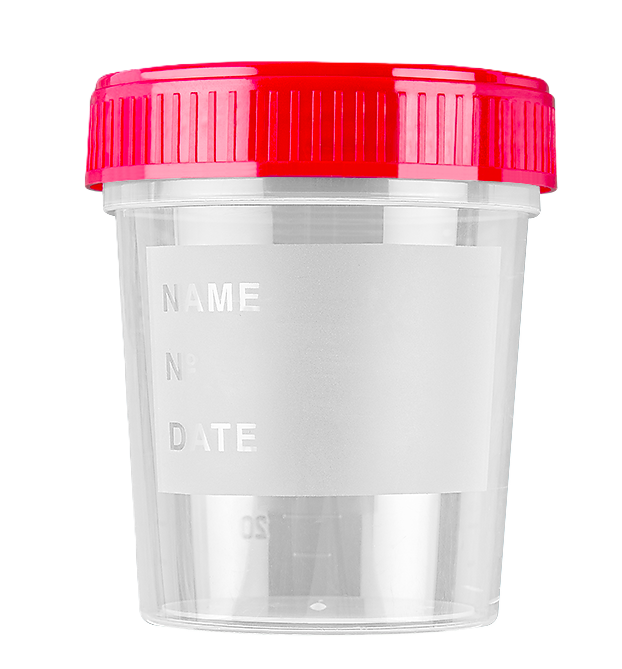 FRASCO DE URO ESTERIL TAPA ROJA